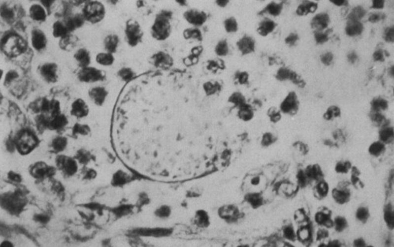 uploads/news/2025/09/kenali-jamur-coccidioides-immitis-419538790adb117.png