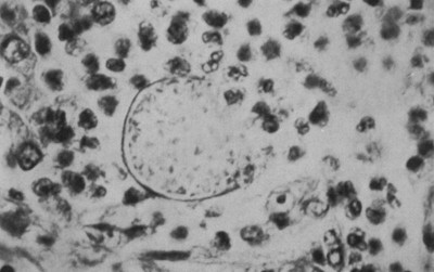 uploads/news/2025/09/kenali-jamur-coccidioides-immitis-419538790adb117_400.png